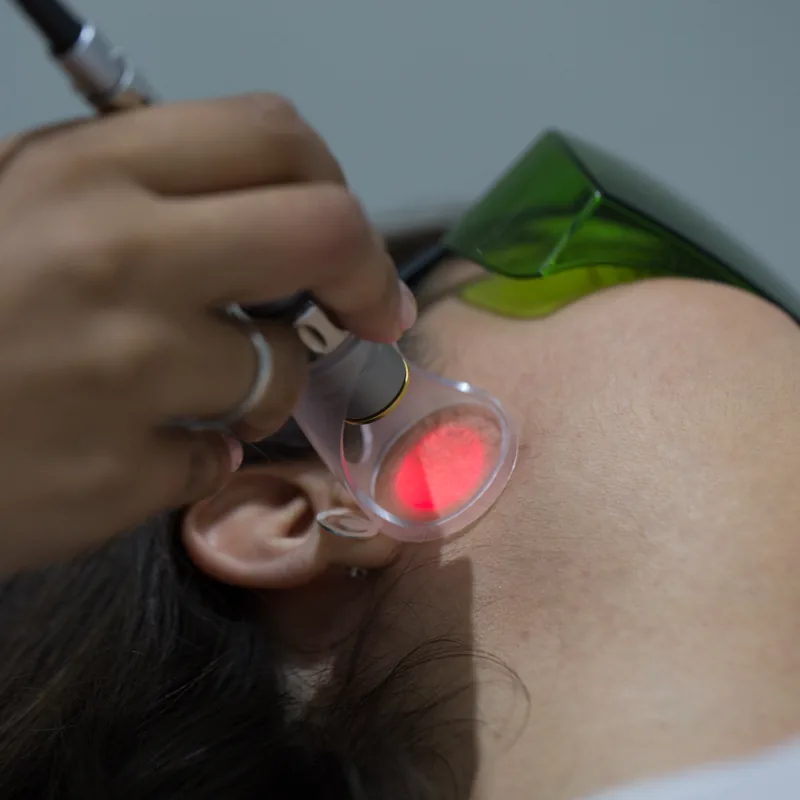 Performing targeted laser therapy