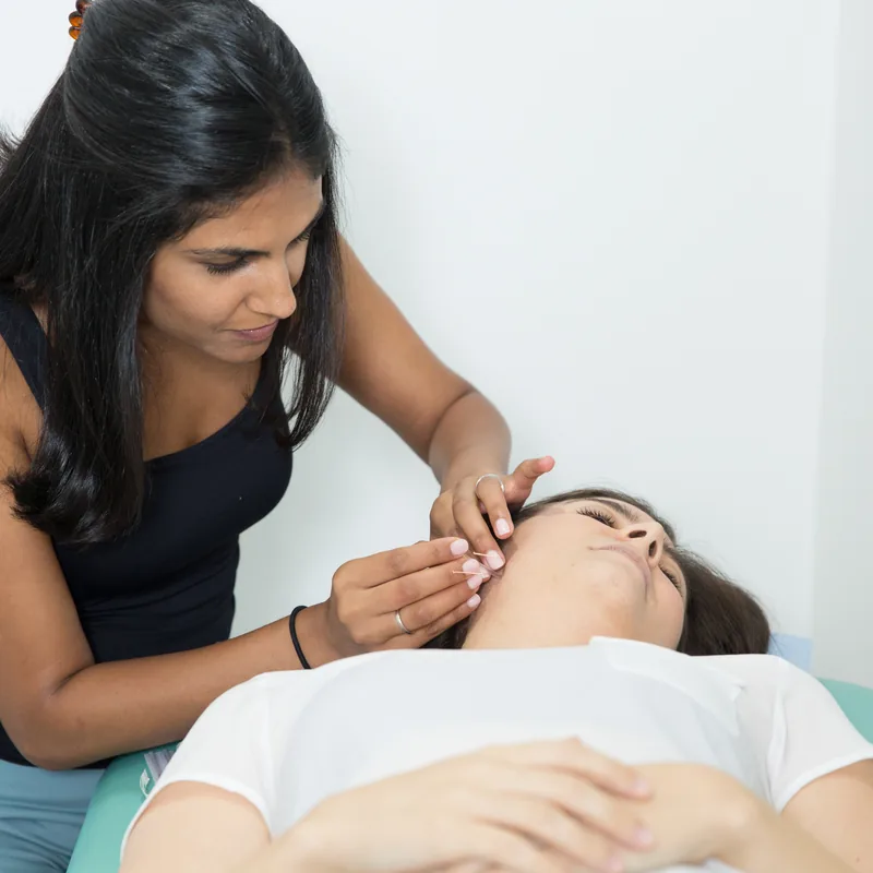 Dry needling a patient's jaw