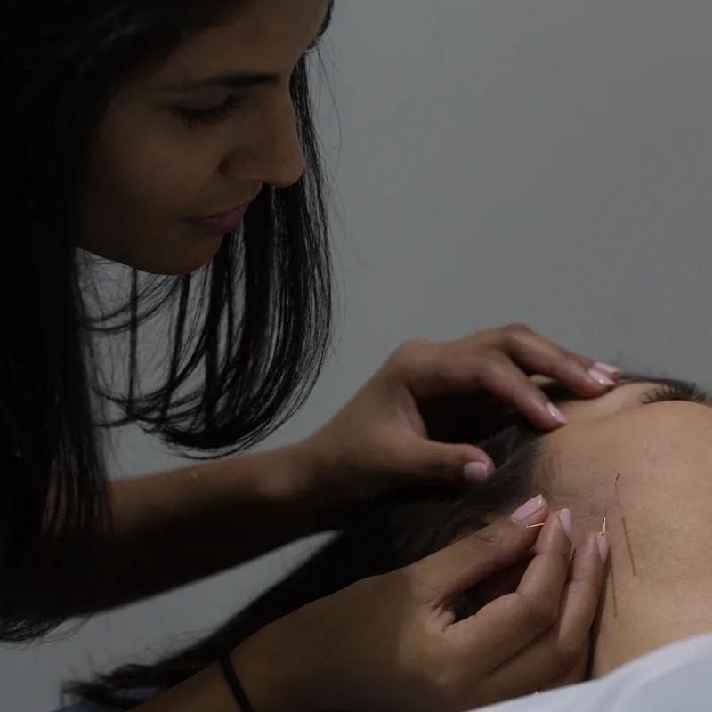 Performing facial needling