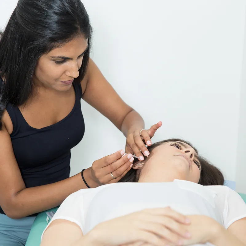 Performing acupuncture treatment